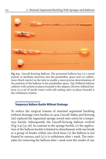 Primary Retinal Detachment
