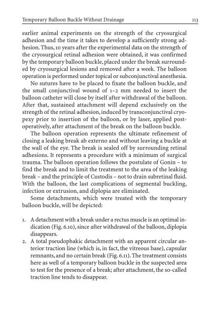 Primary Retinal Detachment