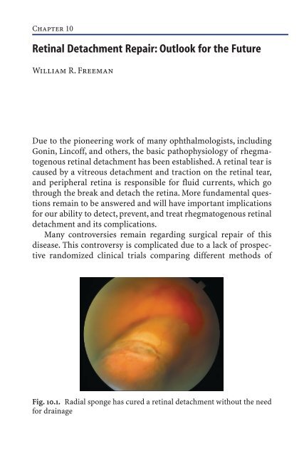 Primary Retinal Detachment