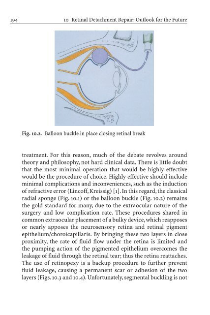Primary Retinal Detachment