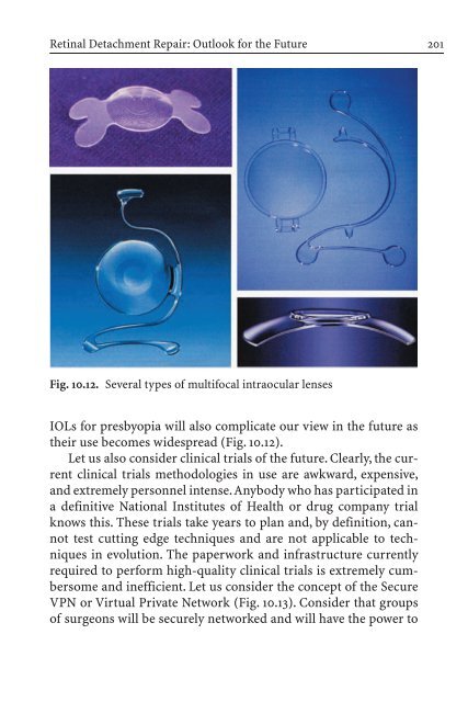 Primary Retinal Detachment