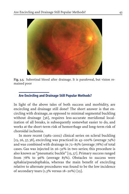 Primary Retinal Detachment
