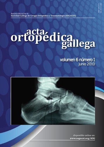 ACTA ORTOP GALLEGA - Sogacot