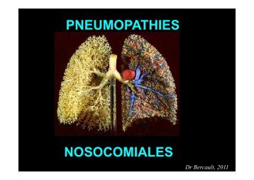 PNEUMOPATHIES NOSOCOMIALES