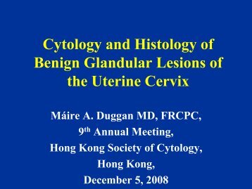 Cytology and Histology of Glandular Lesions - Hong Kong Society of ...