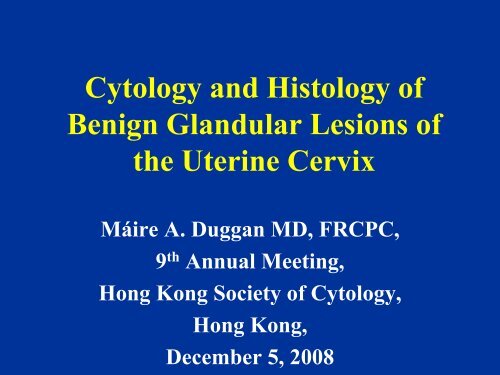 Cytology and Histology of Glandular Lesions - Hong Kong Society of ...