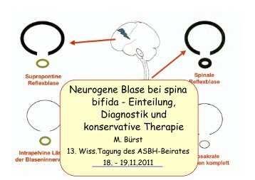Neurogene Blase bei spina bifida - Einteilung, Diagnostik ... - ASbH