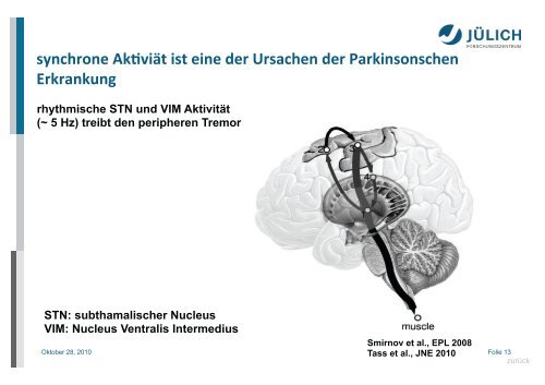 Neue Tinnitus-Therapie auf neuronaler Basis