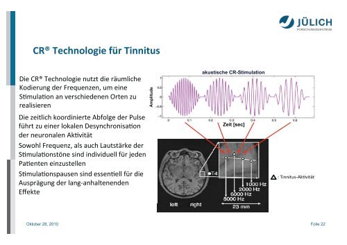 Neue Tinnitus-Therapie auf neuronaler Basis