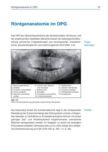 Röntgenanatomie im OPG - Spitta