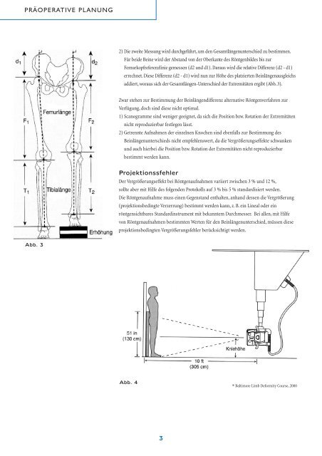 Intramedullärer skelettaler kinetischer Distraktor ISKD - Orthofix.com