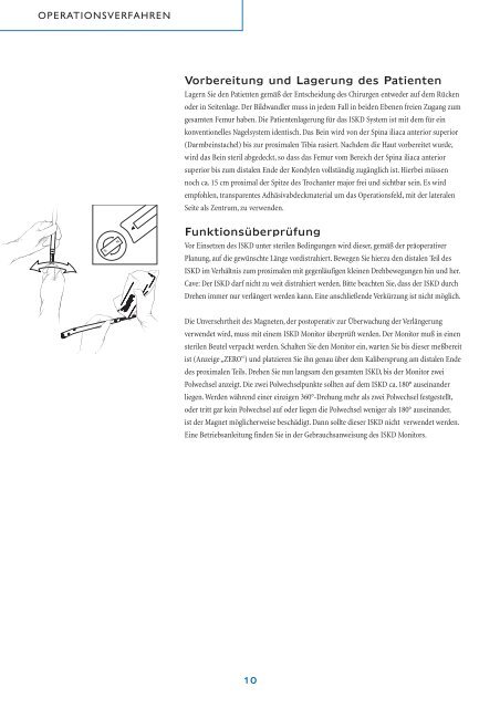 Intramedullärer skelettaler kinetischer Distraktor ISKD - Orthofix.com