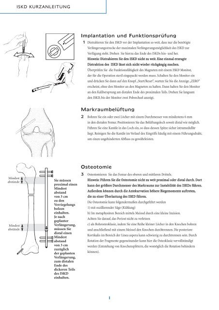 Intramedullärer skelettaler kinetischer Distraktor ISKD - Orthofix.com