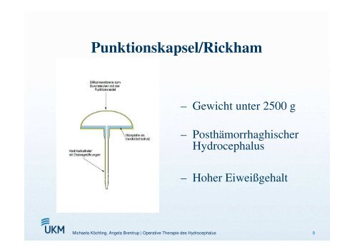 Operative Therapiemöglichkeiten des Hydrozephalus - ASbH