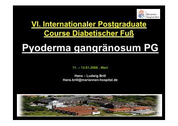 Pyoderma gangränosum PG