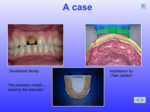 K' volution - Dental Kiefer