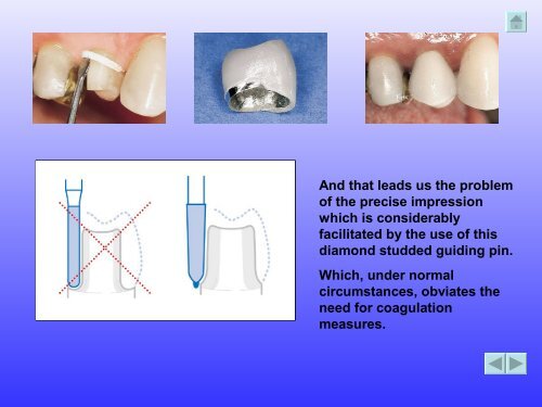 K' volution - Dental Kiefer