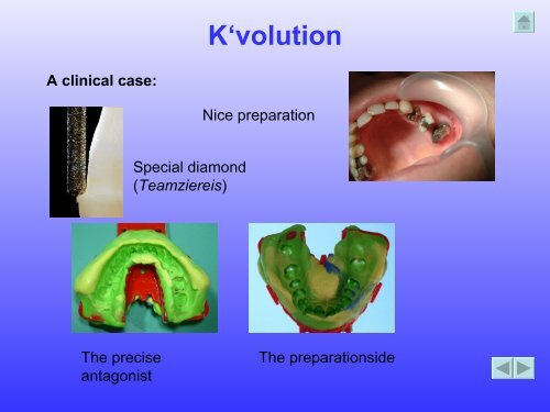 K' volution - Dental Kiefer