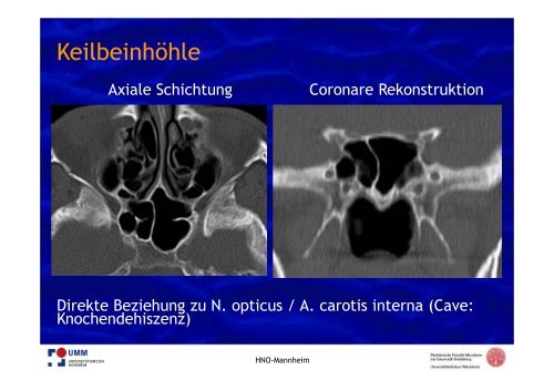 PDF hier herunterladen - HNO-Gemeinschaftspraxis am Kreisel