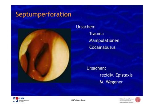 PDF hier herunterladen - HNO-Gemeinschaftspraxis am Kreisel