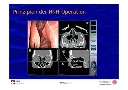 PDF hier herunterladen - HNO-Gemeinschaftspraxis am Kreisel