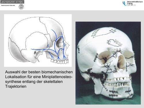 Dysgnathiechirurgie - Gesellschaft für Zahn-, Mund- und ...