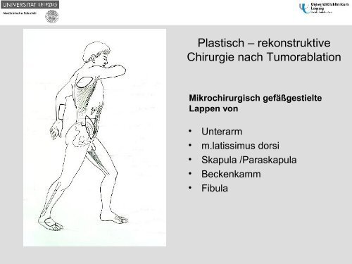 Dysgnathiechirurgie - Gesellschaft für Zahn-, Mund- und ...