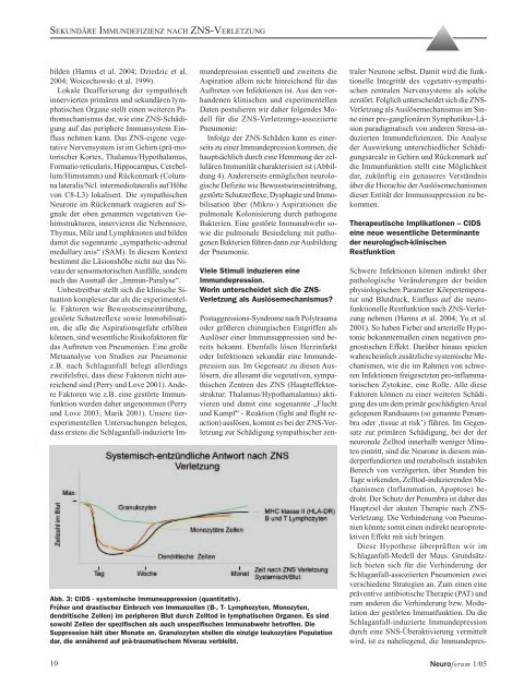 Sekundäre Immundefizienz nach ZNS-Verletzung Intraoperative ...