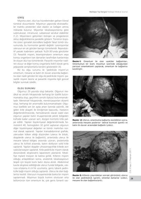 Olgu Sunumu Medial Calcific Sclerosis (Mönckeberg) Case Report