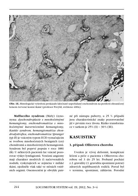 3+4+Supplementum/2012 - Společnost pro pojivové tkáně