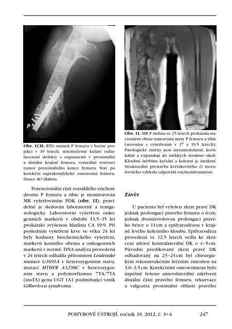 3+4+Supplementum/2012 - Společnost pro pojivové tkáně