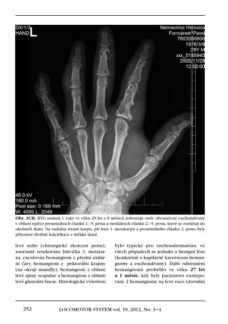 3+4+Supplementum/2012 - Společnost pro pojivové tkáně