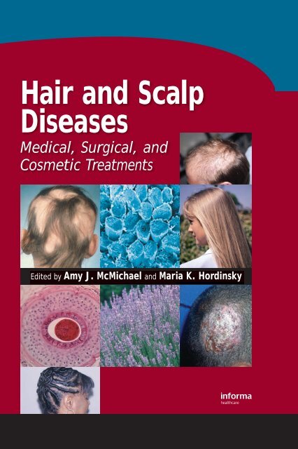 Hair And Scalp Diseases Medical Surgical And Cosmetic