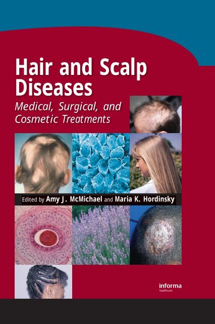 https://img.yumpu.com/9517673/1/500x640/hair-and-scalp-diseases-medical-surgical-and-cosmetic-.jpg