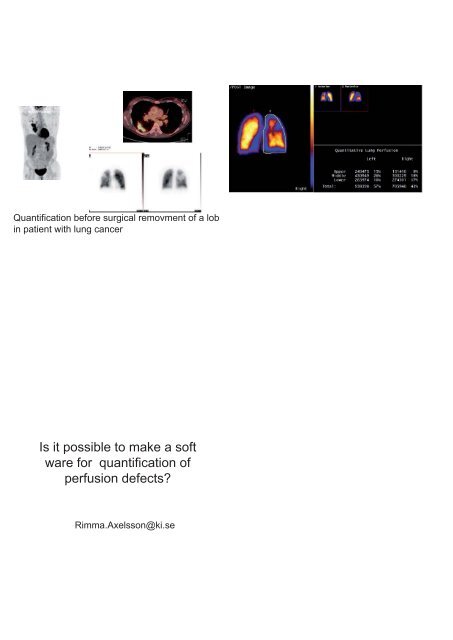 Visualisering av funktionell och morfologisk hjärt-kärl-diagnostik