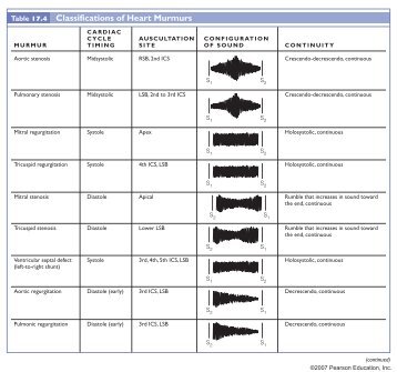 Classifications of Heart Murmurs - Pearson