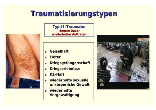 Posttraumatische Belastungsstörung - Psychosomatik ...