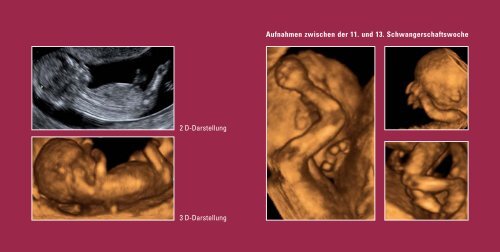 Aufnahmen zwischen der 11. und 13 ... - Dr. Kai Dittmann