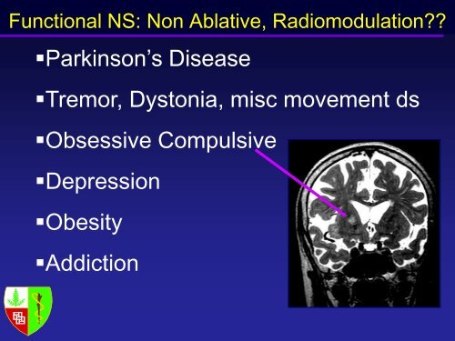 8.3 Adler, A Vision for Radiosurgery - Varian