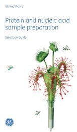 Protein and nucleic acid sample preparation - Whatman
