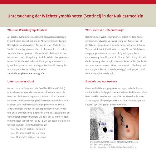 Untersuchung der Wächterlymphknoten - Knappschaftskrankenhaus ...