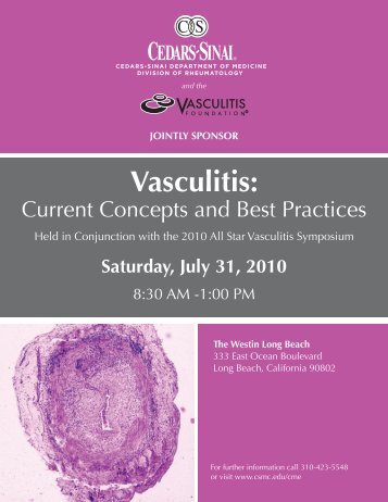 Vasculitis: Current Concepts and Best Practices - Rare Disease