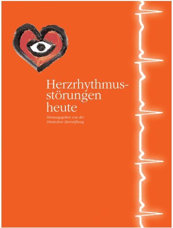 Herzrhythmus- störungen heute - Bagso