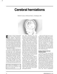 Cerebral herniations - Applied Radiology Online