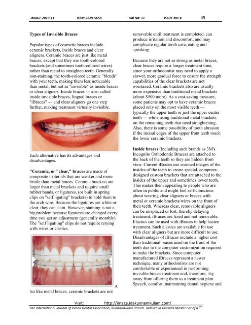 'satisfactory smile' with a restorative approach - Indian Dental ...