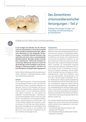 Das Zementieren zirkonoxidkeramischer Versorgungen - dcm ...