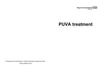 PUVA treatment - Royal Free Hampstead NHS Trust