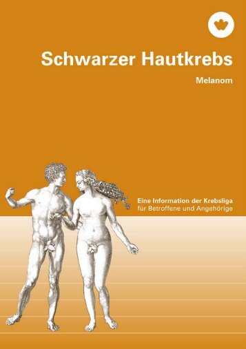 Schwarzer Hautkrebs - Krebsliga Zentralschweiz