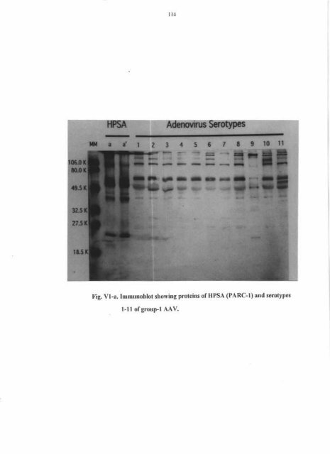 HYDROPXRICAru)II'M SYI{DROME (ANGARA DISEASE) IN ...